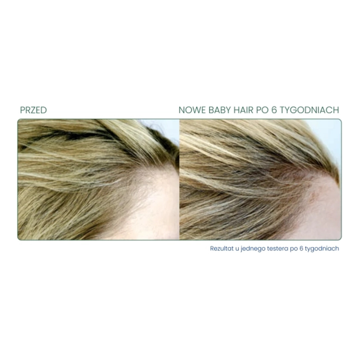 Novaclear Hair Ampułki przeciw wypadaniu włosów (15x5ml) 75ml