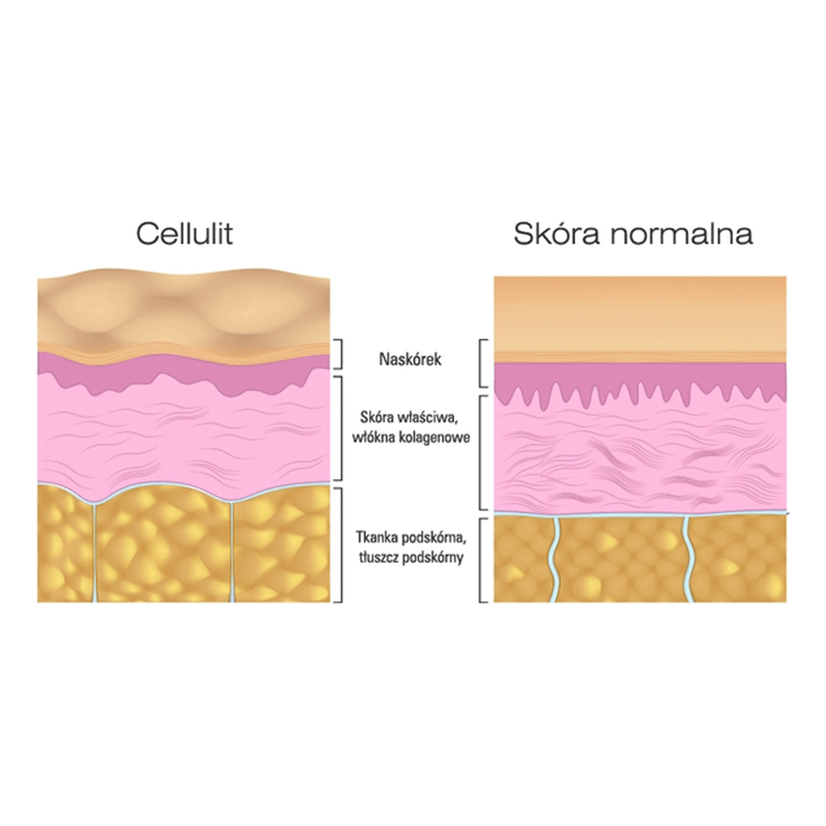 BINGOSPA Koncentrat Cynamonowo - Algowy Z L-Karnityną 250g