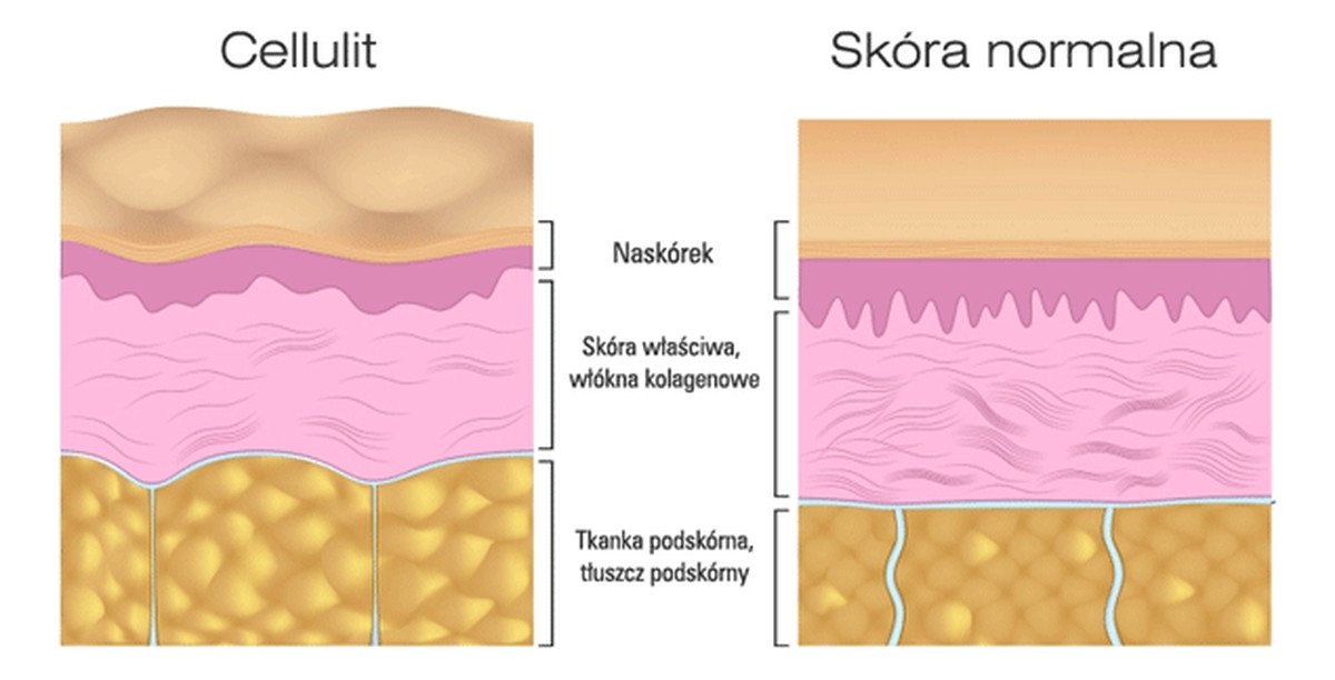 Koncentrat Cynamonowo - Algowy Z L-Karnityną