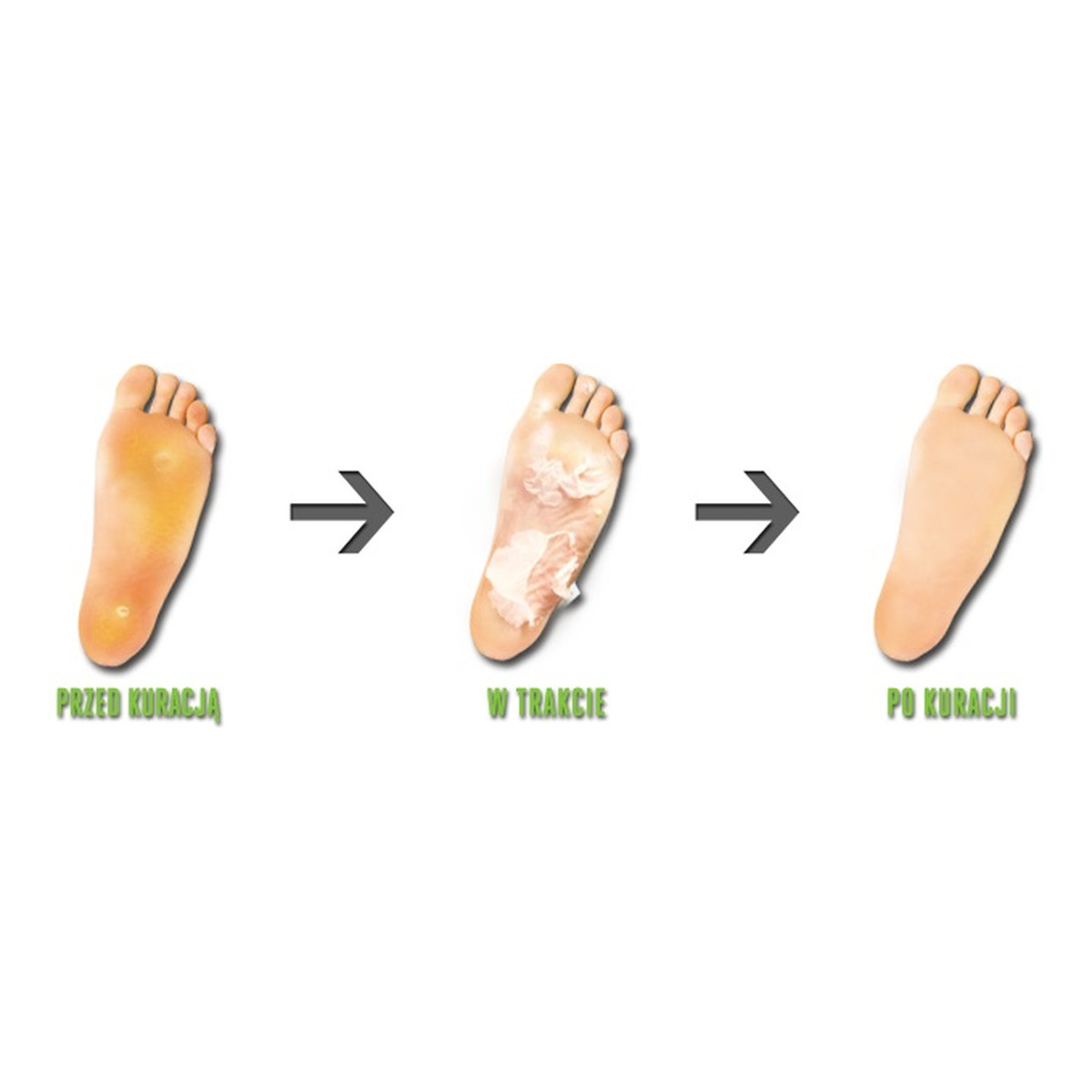 Soulima Kuracja Złuszczająca Do Stóp Skarpetki Złuszczajace